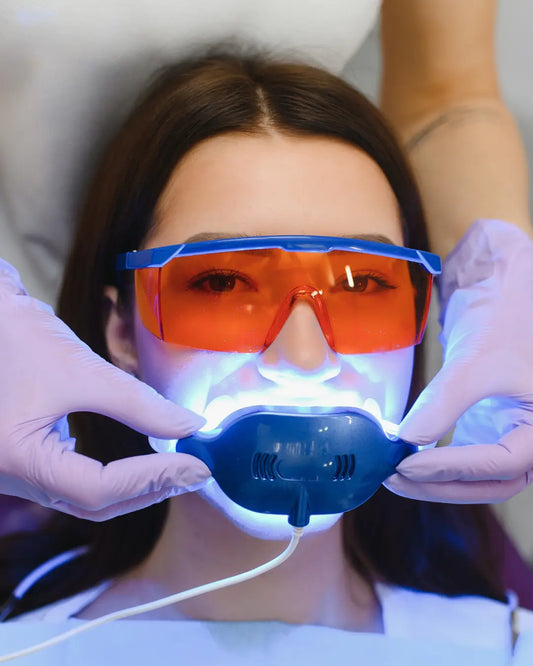 Sbiancamento dentale professionale: cos’è, come funziona e come mantenere i risultati a casa Smile RITUALS